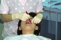 歯科衛生士によるPMTC