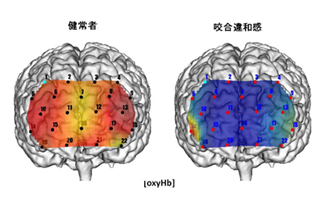 顎関節・咬合科