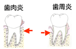 歯周科 歯科衛生士